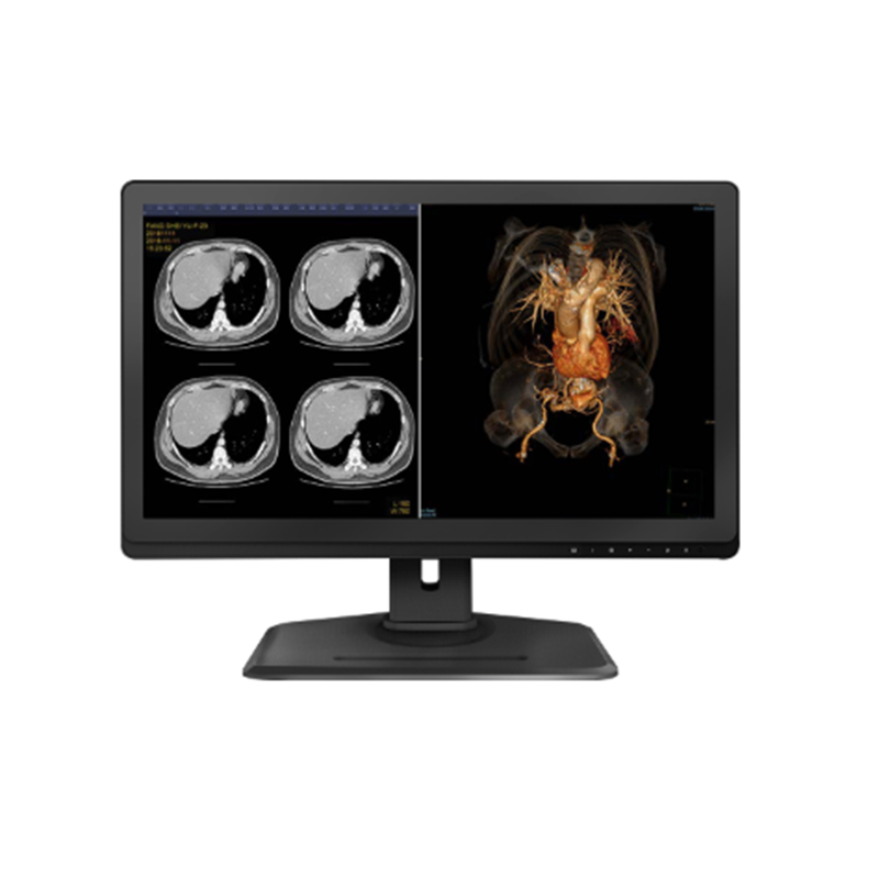 Diagnostic Medical Display